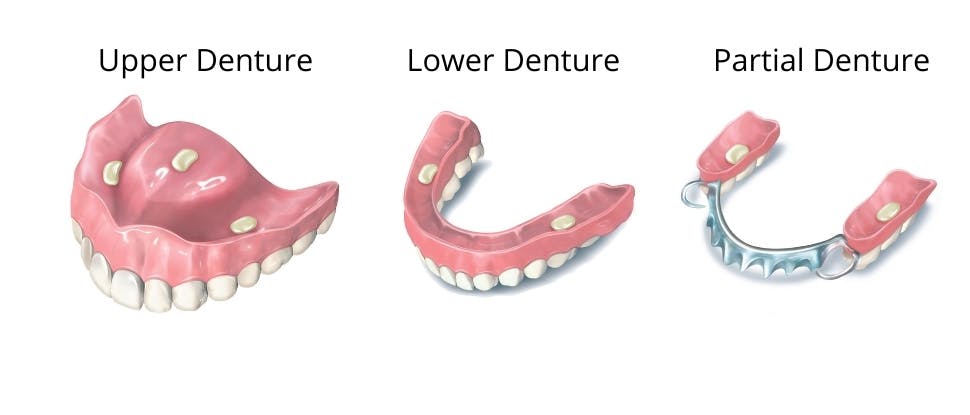 Polident Denture Adhesive | Haleon HealthPartner